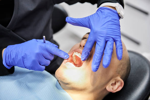 Best Cracked Tooth Emergency Dentist  in Chelsea, MI
