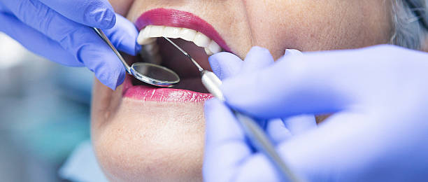 Best Knocked-Out Tooth Emergency  in Chelsea, MI